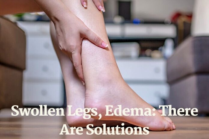 Swollen Legs, Edema There Are Solutions