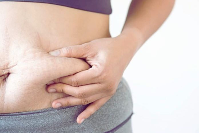 Is It Possible To Lose Localized Fat